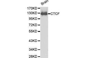 Image no. 1 for anti-CCCTC-Binding Factor (Zinc Finger Protein) (CTCF) antibody (ABIN3021507)