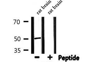 Image no. 3 for anti-Proteasome (Prosome, Macropain) 26S Subunit, Non-ATPase, 12 (PSMD12) (Internal Region) antibody (ABIN6257738)