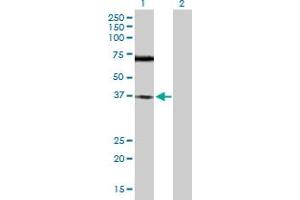 Image no. 3 for anti-three Prime Repair Exonuclease 1 (TREX1) (AA 1-369) antibody (ABIN524703)