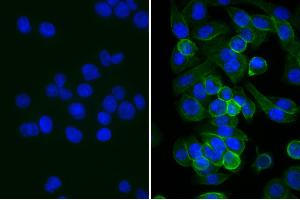 Human pancreatic carcinoma cell line MIA PaCa-2 was blocked with Normal Rabbit Serum, and DAPI.