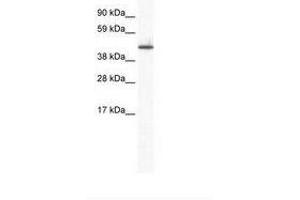 Image no. 1 for anti-Zinc Finger Protein 557 (ZNF557) (AA 298-347) antibody (ABIN6736004)