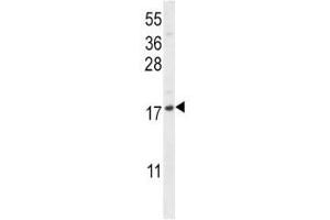 Image no. 3 for anti-Chemokine (C-X-C Motif) Ligand 12 (CXCL12) (AA 64-92) antibody (ABIN3030504)