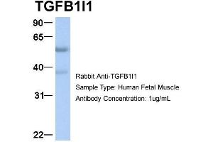 Image no. 3 for anti-Transforming Growth Factor beta 1 Induced Transcript 1 (TGFB1I1) (Middle Region) antibody (ABIN2777947)