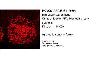 Image no. 1 for anti-Homeobox C6 (HOXC6) (C-Term) antibody (ABIN2780601)