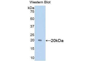 Image no. 1 for anti-Sex Hormone Binding Globulin (SHBG) (AA 222-358) antibody (ABIN1172841)