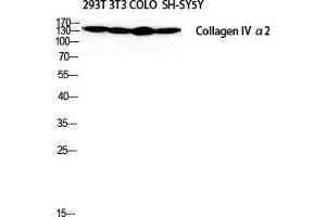 Image no. 2 for anti-Collagen, Type IV, alpha 2 (COL4A2) (N-Term) antibody (ABIN3184013)