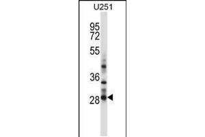 Image no. 1 for anti-Homeobox C4 (HOXC4) (AA 197-225), (C-Term) antibody (ABIN5532584)