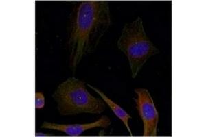Image no. 3 for anti-Growth Associated Protein 43 (GAP43) (Ser41) antibody (ABIN197546)