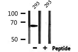 Image no. 2 for anti-Protein Inhibitor of Activated STAT, 2 (PIAS2) antibody (ABIN6264196)