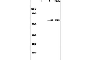 Image no. 1 for anti-Sirtuin 1 (SIRT1) (AA 101-200) antibody (ABIN729853)