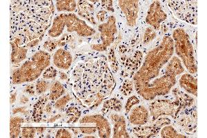 Image no. 1 for anti-Arginase, Liver (ARG1) (C-Term) antibody (ABIN570917)