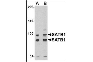 Image no. 2 for anti-SATB Homeobox 1 (SATB1) (C-Term) antibody (ABIN500670)
