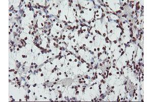 Image no. 13 for anti-Fragile X Mental Retardation 1 (FMR1) (AA 36-279) antibody (ABIN1491454)