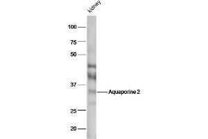 Image no. 3 for anti-Aquaporin 2 (Collecting Duct) (AQP2) (AA 171-271) antibody (ABIN707576)