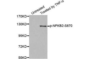 Image no. 1 for anti-Nuclear Factor of kappa Light Polypeptide Gene Enhancer in B-Cells 2 (NFKB2) (pSer870) antibody (ABIN3020406)
