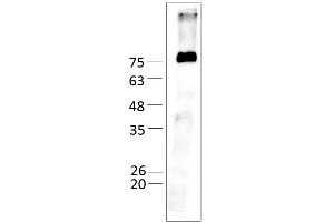 Western Blotting (WB) image for delta-Like 1 Homolog (Drosophila) (DLK1) (AA 24-383) protein (rho-1D4 tag,MBP tag) (ABIN3078896)