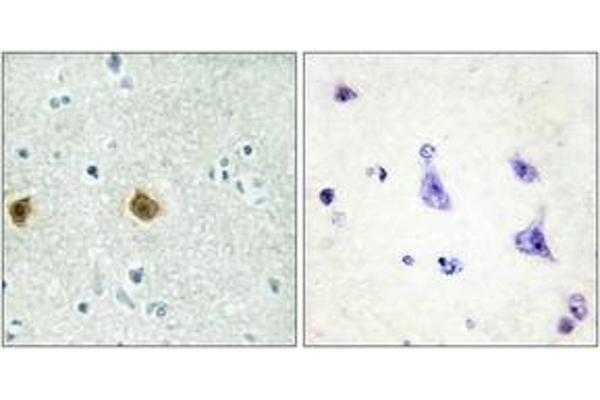 NDUFC2 antibody  (AA 51-100)