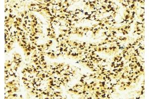 Image no. 3 for anti-Mucosa Associated Lymphoid Tissue Lymphoma Translocation Gene 1 (MALT1) antibody (ABIN6263086)