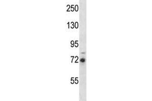 RIPK1 antibody western blot analysis in MDA-MB231 lysate.