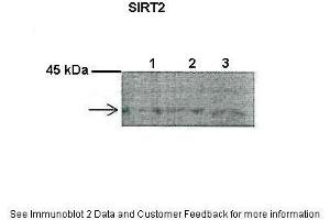 Image no. 2 for anti-Sirtuin 2 (SIRT2) (C-Term) antibody (ABIN2779606)