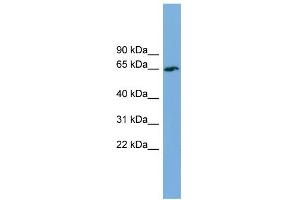 Image no. 1 for anti-TBC1 Domain Family, Member 24 (TBC1D24) (Middle Region) antibody (ABIN2787224)