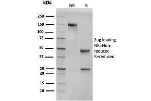 Image no. 1 for anti-SERPINE1 mRNA Binding Protein 1 (SERBP1) (AA 3-139) antibody (ABIN6939489)