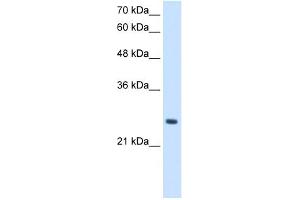anti-phosphopantothenoylcysteine Decarboxylase (PPCDC) (N-Term) antibody