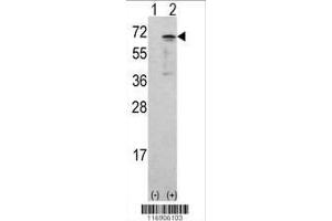 Image no. 2 for anti-Calcium/calmodulin-Dependent Protein Kinase Kinase 1, alpha (CAMKK1) (AA 337-369) antibody (ABIN392190)