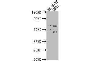 CSRNP3 antibody  (AA 518-536)