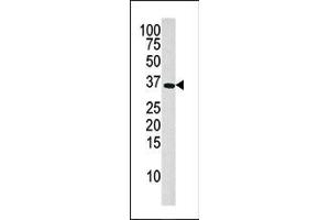 Image no. 1 for anti-Deoxyguanosine Kinase (DGUOK) (N-Term) antibody (ABIN359185)