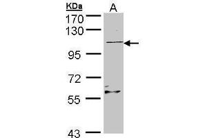 Image no. 2 for anti-Ral Guanine Nucleotide Dissociation Stimulator-Like 2 (RGL2) (Center) antibody (ABIN2856144)