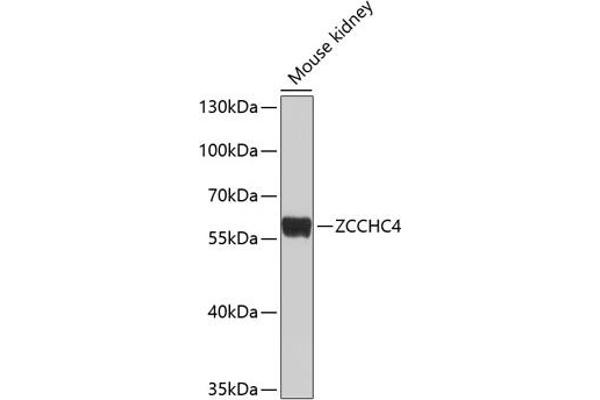 ZCCHC4 抗体  (AA 50-220)