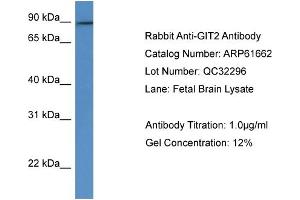 Image no. 1 for anti-G Protein-Coupled Receptor Kinase Interactor 2 (GIT2) (C-Term) antibody (ABIN2788863)