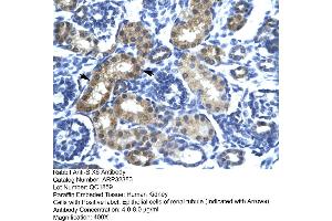 Image no. 2 for anti-SIX Homeobox 6 (SIX6) (N-Term) antibody (ABIN2779603)
