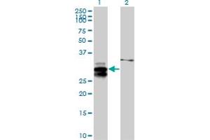 Western Blot analysis of ULBP2 expression in transfected 293T cell line by ULBP2 MaxPab polyclonal antibody.