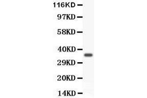 Image no. 2 for anti-Forkhead Box M1 (FOXM1) (AA 411-763) antibody (ABIN3042402)