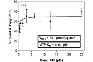 Image no. 2 for Proto-Oncogene Pim-2 (Serine Threonine Kinase) (PIM2) (AA 1-311) protein (His-GST) (ABIN5569599)