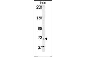 Image no. 2 for anti-Excision Repair Cross-Complementing Rodent Repair Deficiency, Complementation Group 6-Like 2 (ERCC6L2) (AA 12-43), (N-Term) antibody (ABIN954433)