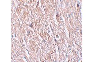 Immunohistochemistry (IHC) image for anti-Leucine Rich Repeat Transmembrane Neuronal 4 (LRRTM4) (Middle Region) antibody (ABIN1030989)