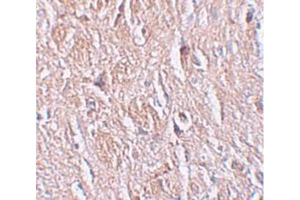 anti-Leucine Rich Repeat Transmembrane Neuronal 4 (LRRTM4) (Middle Region) antibody