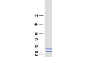Image no. 1 for Calcineurin B (CAN) protein (Myc-DYKDDDDK Tag) (ABIN2729504)
