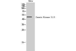 Image no. 1 for anti-Casein Kinase 1, gamma 2 (CSNK1G2) (N-Term) antibody (ABIN3183661)