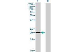 Western Blot analysis of HCCA2 expression in transfected 293T cell line by HCCA2 MaxPab polyclonal antibody.
