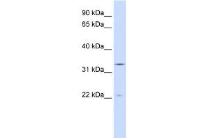 INMT anticorps  (N-Term)