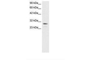 Image no. 3 for anti-Orthodenticle Homeobox 2 (OTX2) (AA 86-135) antibody (ABIN6735803)
