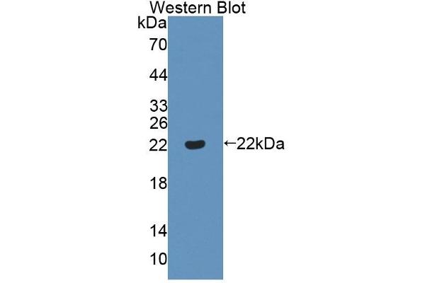 ADAMTS13 antibody  (AA 896-1131)