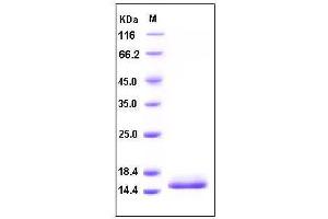 Image no. 1 for Cystatin D (CST5) (AA 1-142), (Proform) protein (His tag) (ABIN2002971)