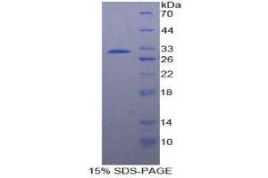 Image no. 1 for Heat Shock 70kDa Protein 4 (HSPA4) (AA 258-511) protein (His tag) (ABIN1879356)