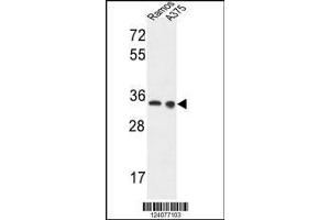 Image no. 1 for anti-Lactate Dehydrogenase A (LDHA) (AA 154-182) antibody (ABIN653476)