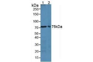 Image no. 3 for Lactotransferrin (LTF) ELISA Kit (ABIN6574204)
